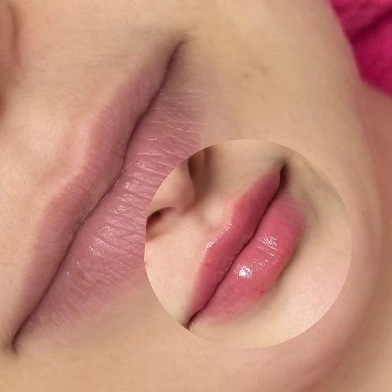 Before and after lip filler result showing natural enhancement with 1/2 syringe at Ash's Lashes and Esthetics