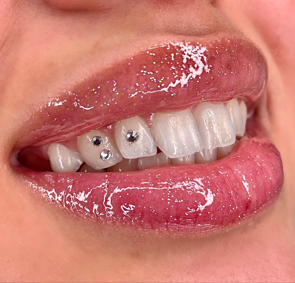 Swarovski tooth gems applied to teeth close-up